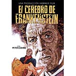 El cerebro de Frankenstein