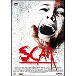 Scar