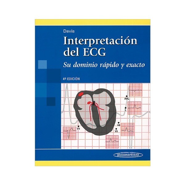 Davis:interpretaci—n del ecg 4a. Ed..pdf