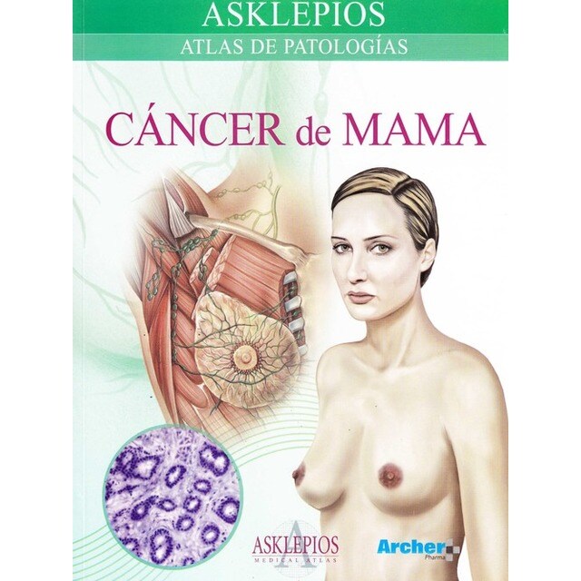 Cáncer de mama.pdf