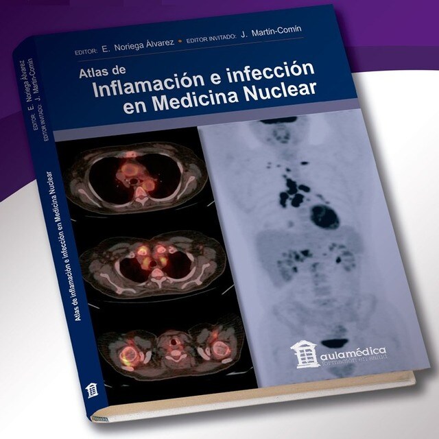 ATLAS DE INFLAMACION E INFECCION EN MEDICINA NUCLEAR.pdf