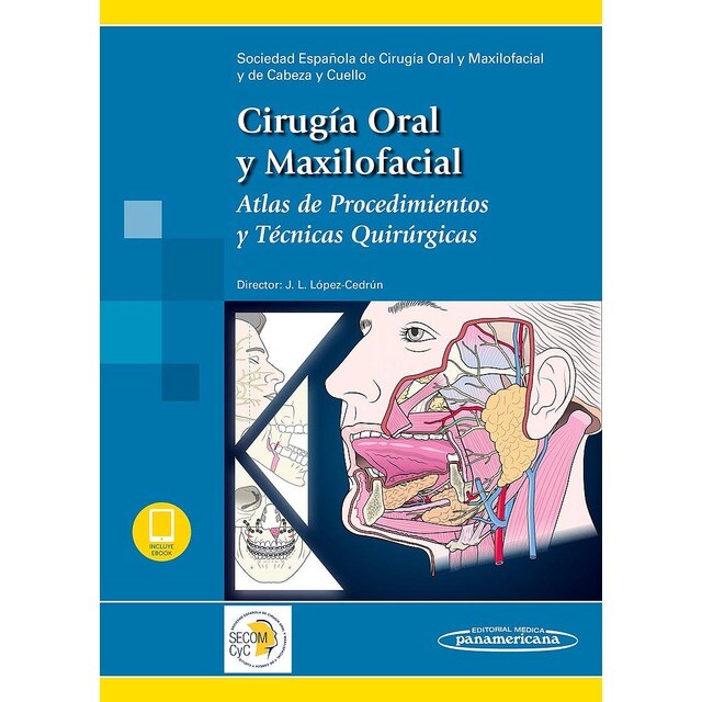 Cirugía Oral y Maxilofacial. Atlas de Procedimientos y Técnicas Quirúrgicas + ebook.pdf