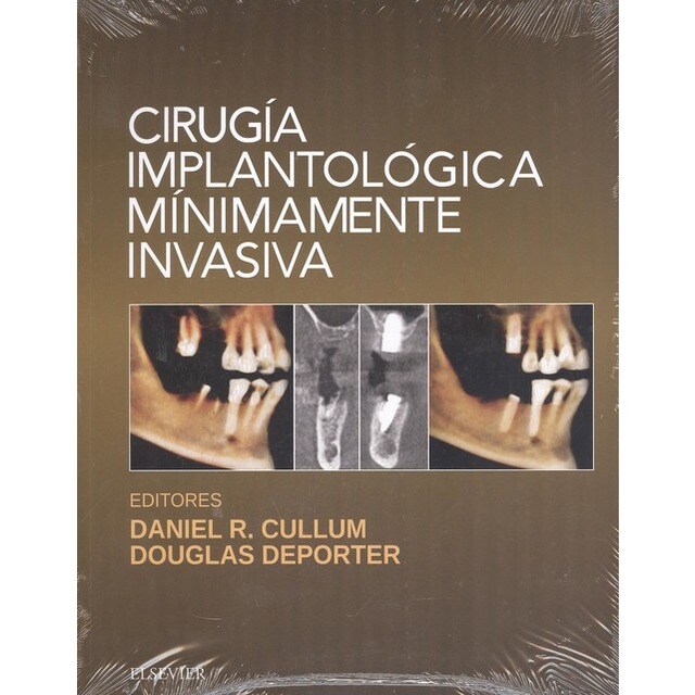 CIRUGÍA IMPLANTOLÓGICA MINIMAMENTE INVASIVA.pdf