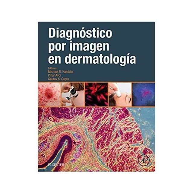 DIAGNÓSTICO POR IMAGEN EN DERMATOLOGÍA.pdf