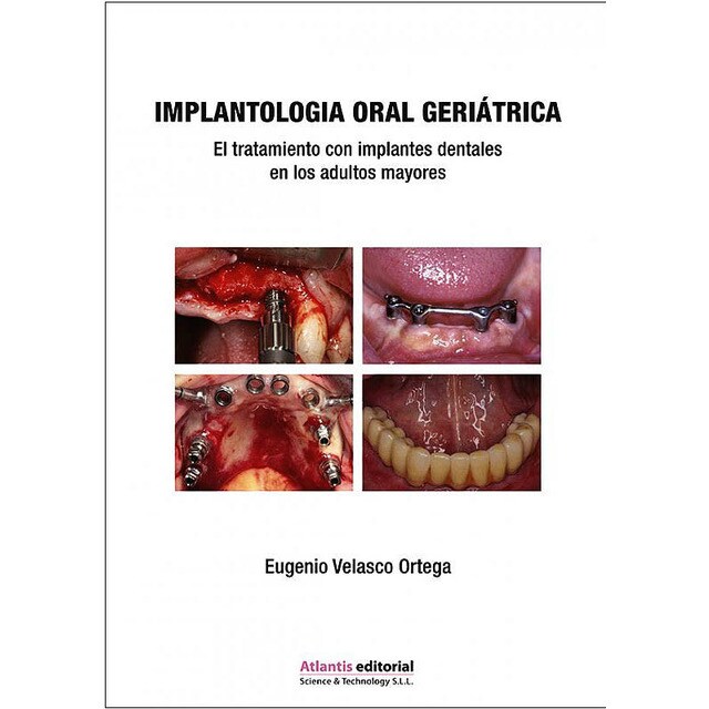 Implantología Oral Geriátrica. El Tratamiento con Implantes Dentales en los Adultos Mayores.pdf