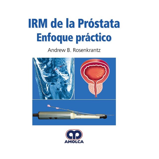 IRM de la Próstata. Enfoque Práctico.pdf