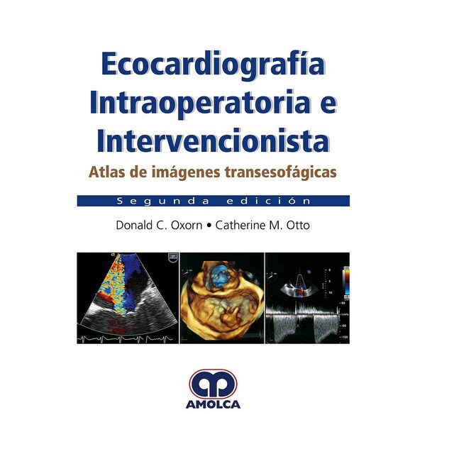 Ecocardiografía Intraoperatoria e Intervencionista.pdf