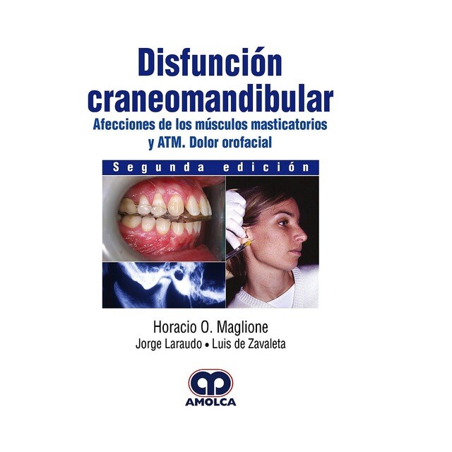 Disfunción Craneomandibular.pdf