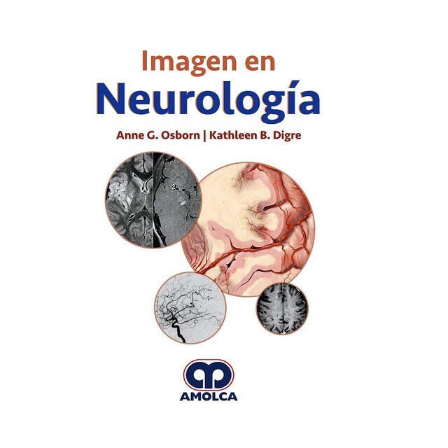 Imagen en Neurología.pdf