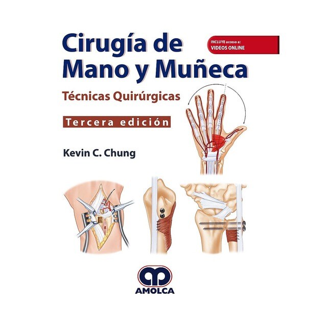 Cirugía de Mano y Muñeca. Técnicas Quirúrgicas.pdf