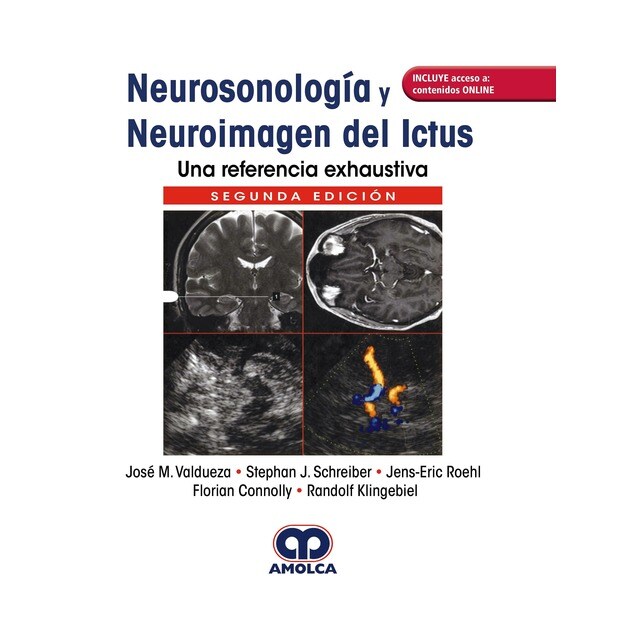 Neurosonología y Neuroimagen del Ictus. Una Referencia Exhaustiva + Acceso a Contenidos Online.pdf