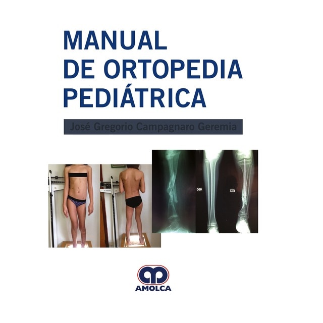 Manual de Ortopedia Pediátrica.pdf
