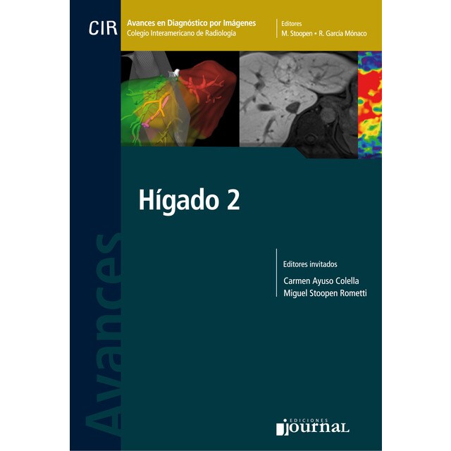 AVANCES EN DIAGNOSTICO POR IMAGENES 16.pdf