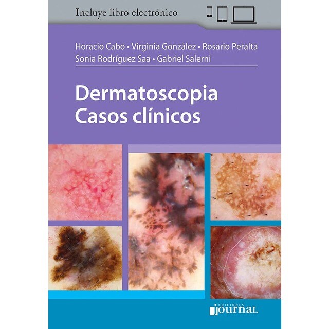 Dermatoscopia. Casos Clínicos + ebook.pdf