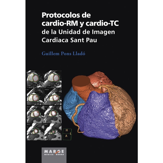 Protocolos de cardio-rm y cardio-tc de la unidad de imagen cardiaca sant pau.pdf