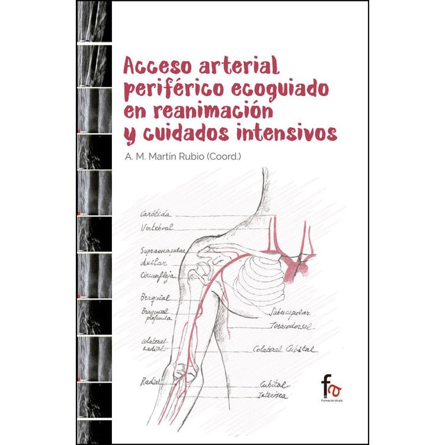 Acceso arterial periférico ecoguiado en reanimación y ciudad (Tapa blanda)