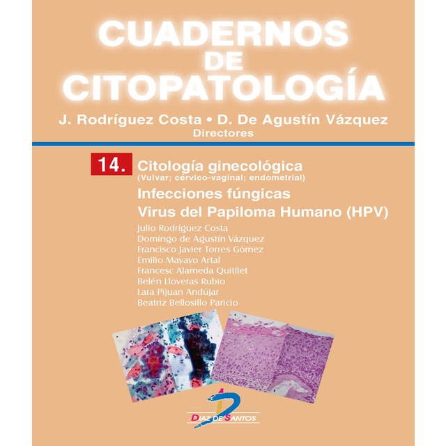 Citología ginecológica: infecciones fúngicas. Virus.pdf