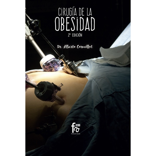 Cirugía de la obesidad