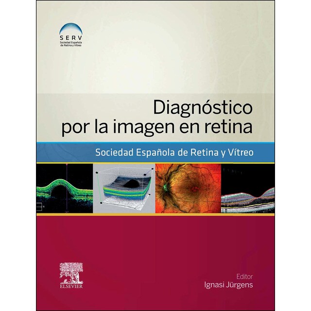 Diagnóstico por la imagen en retina.pdf
