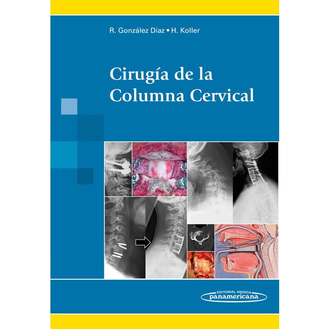 Gonzalez:ciruga columna cervical.pdf