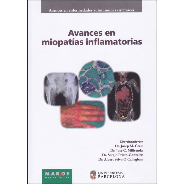 Avances en miopatías inflamatorias (Tapa blanda)