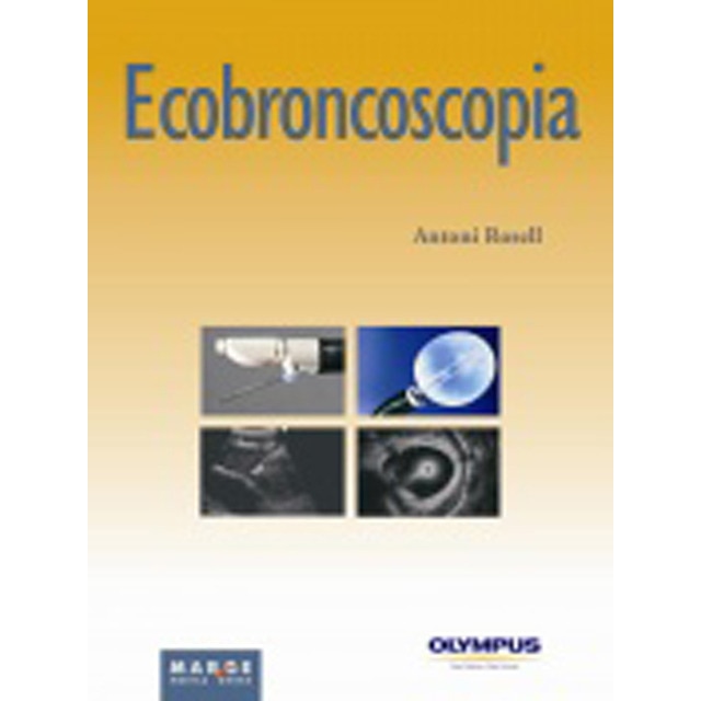 Ecobroncoscopia (Tapa blanda)