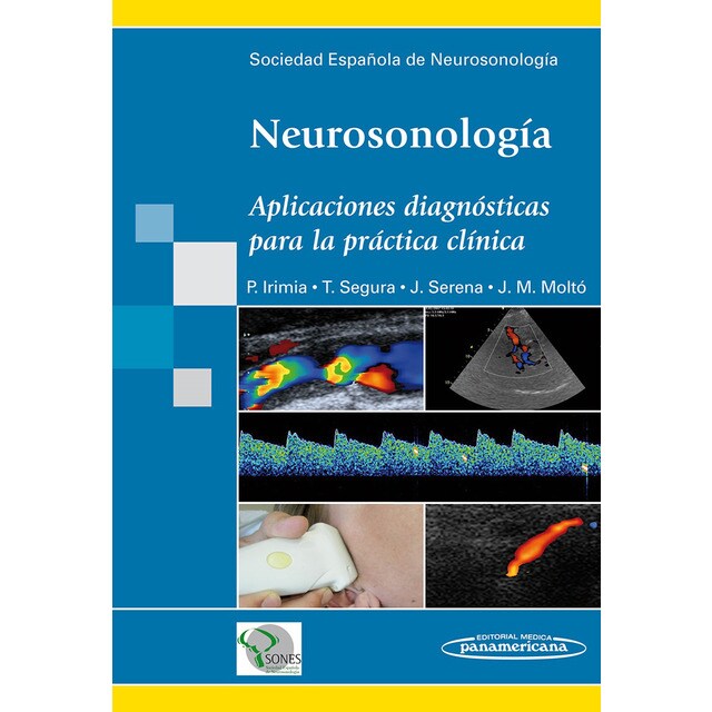 Neurosonología: Aplicaciones diagnósticas para la práctica clínica.pdf