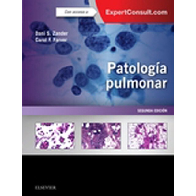 Patología pulmonar + expertconsult.pdf
