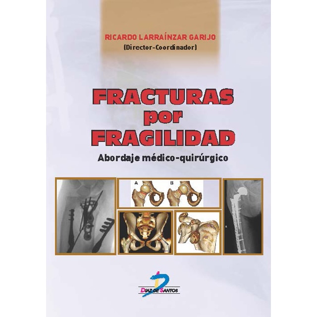 Fracturas por fragilidad: Abordaje médico quirúrgico.pdf