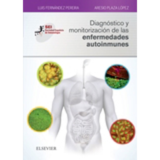 Diagnóstico y monitorización de las enfermedades autoinmunes.pdf