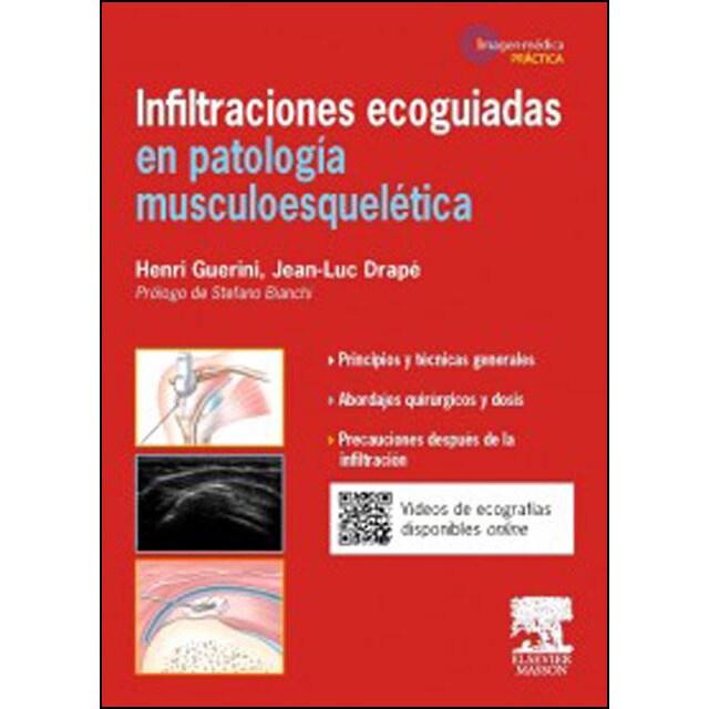Infiltraciones ecoguiadas en patología musculoesquelética.pdf