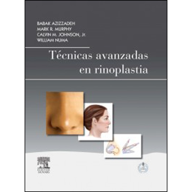 Técnicas avanzadas en rinoplastia + studentconsul.pdf