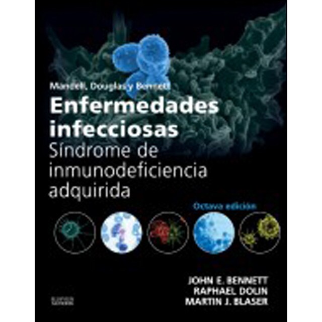 Enfermedades infecciosas: Síndrome de inmunodeficiencia adquirida.pdf
