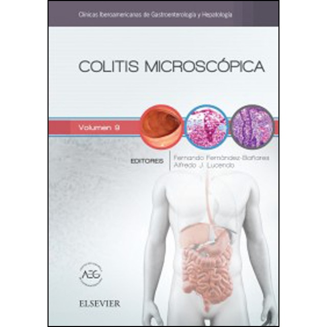 Colitis microscópica © 2016 ed1.pdf