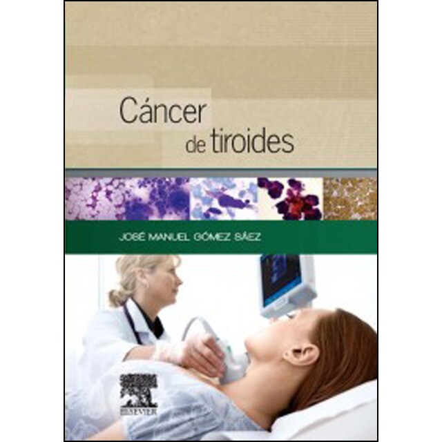 Cáncer de tiroides © 2014 ed1