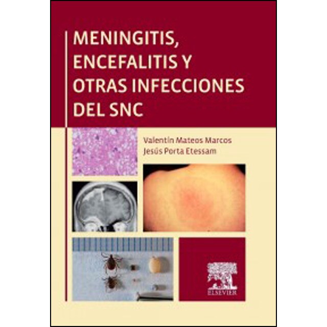 Meningitis encefalitis y otras infecciones del s.pdf