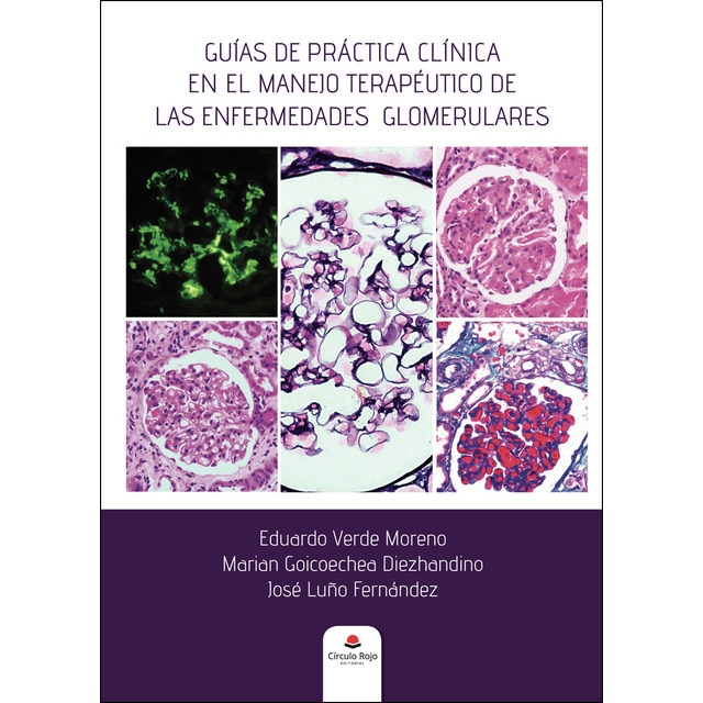 Guías de práctica clínica en el manejo terapéutico de las enfermedades glomerulares.pdf