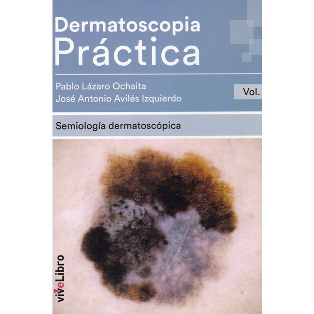 Dermatoscopia practica - vol. 1.pdf