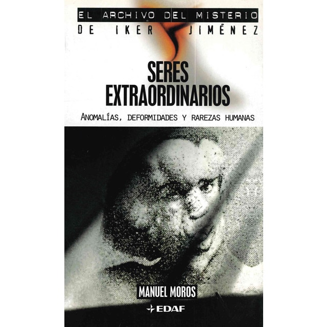 Seres extraordinarios: Anomalías, deformidades y rarezas humanas