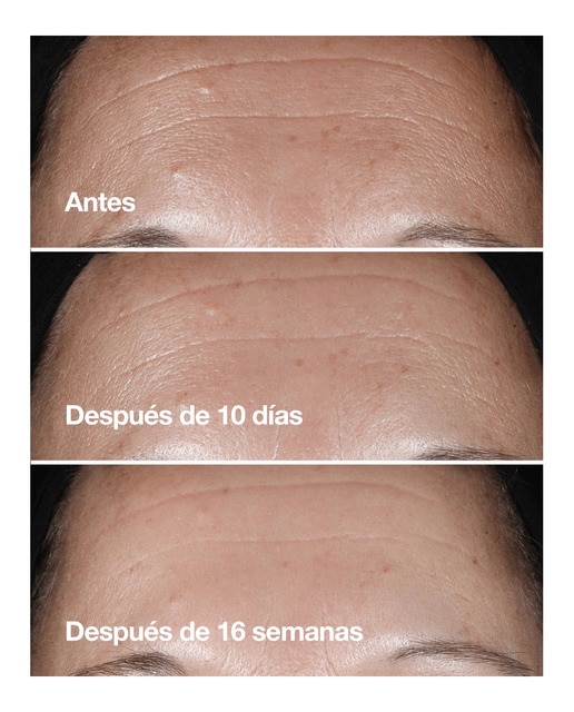 Thumbnail 1 de Clinique Smart Clinical Repair Serum 75 ml antiedad